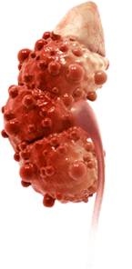 Sick kidney image